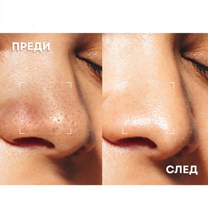PŪR SKIN™ Вулканичен Почистващ Стик